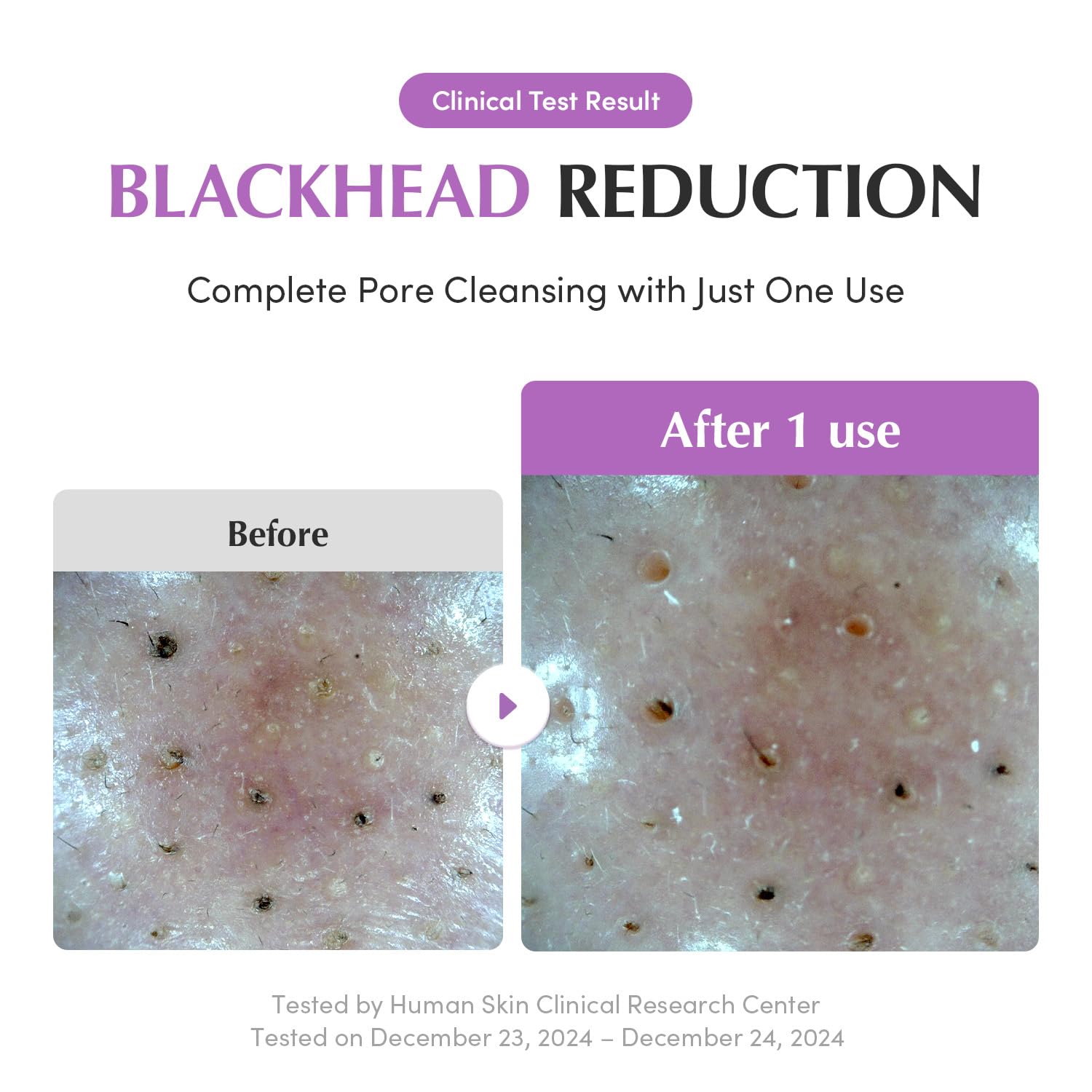 EQQUALBERRY Purple Rice Pore Purifying Cleanser 130g