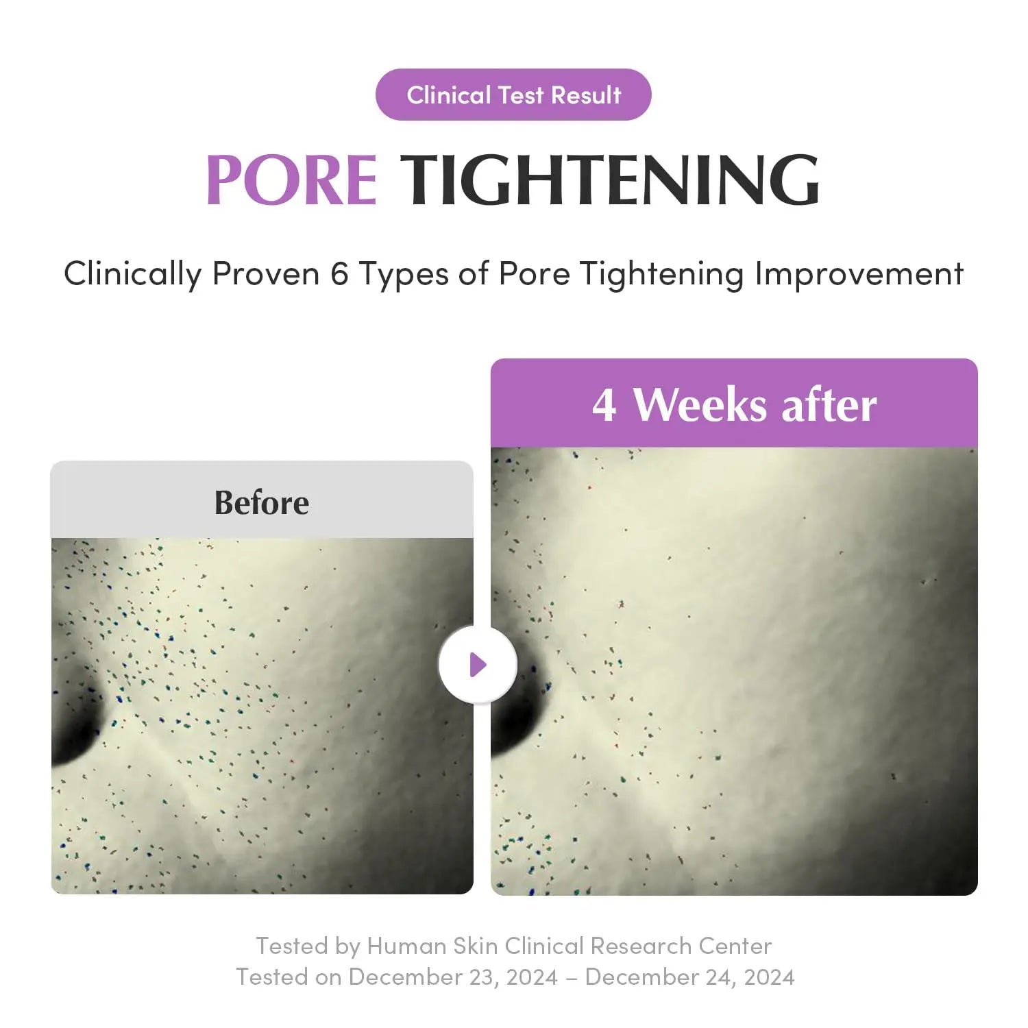 Eqqualberry Purple PDRN Pore Minimizing Serum 1.01 FL OZ Eqqualberry