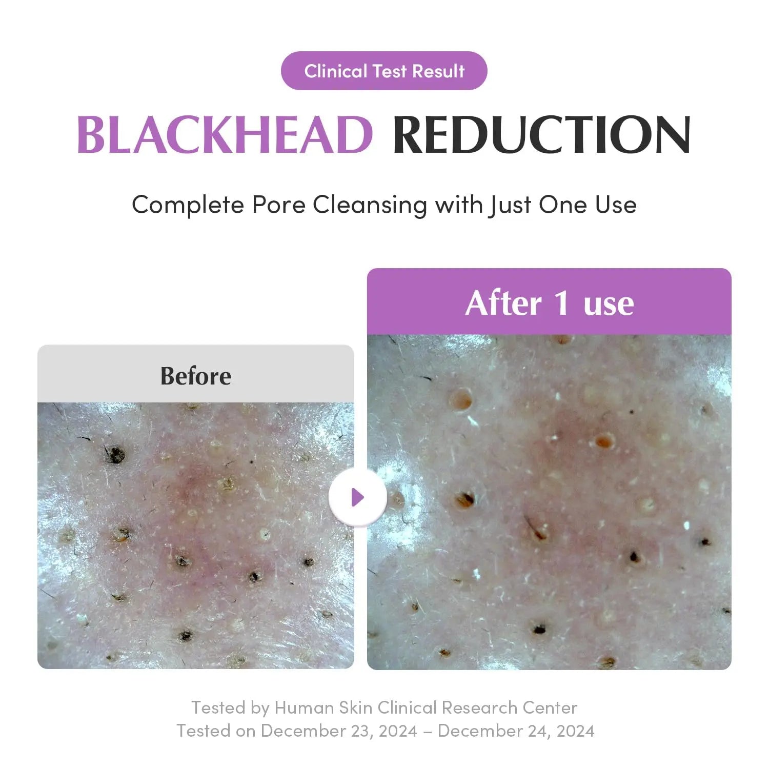 Eqqualberry Purple Rice Pore Purifying Pack Cleanser 4.58 OZ Eqqualberry