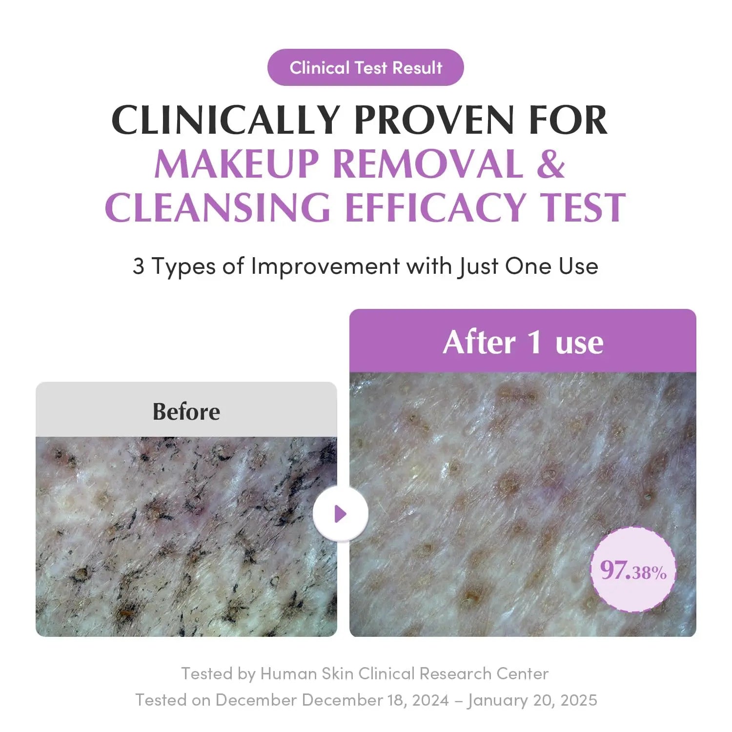 Eqqualberry Purple Rice Pore Smoothing Cleansing Oil 6.76 fl.oz Eqqualberry